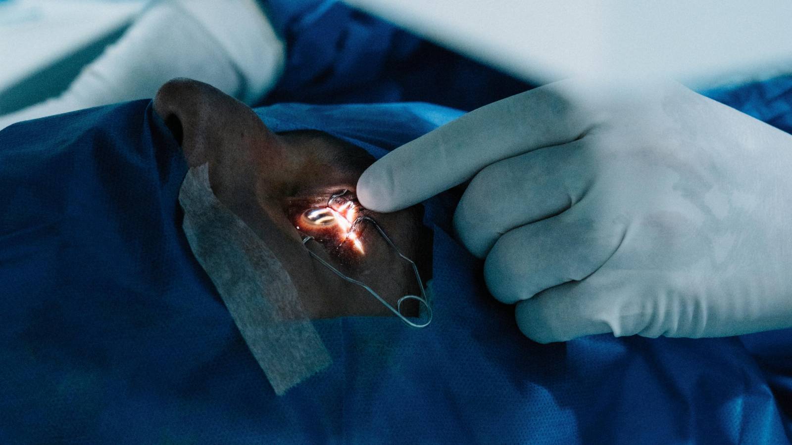 Cataract surgery and lens replacement (placeholder)